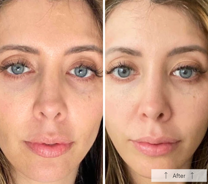 Omnilux Contour Face - Red Light Therapy Mask